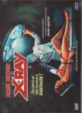 X-Ray (uncut) Cover C Limited 131