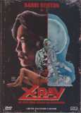 X-Ray (uncut) Cover B Limited 131