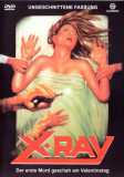 X-Ray - Der erste Mord geschah am Valentinstag (uncut)
